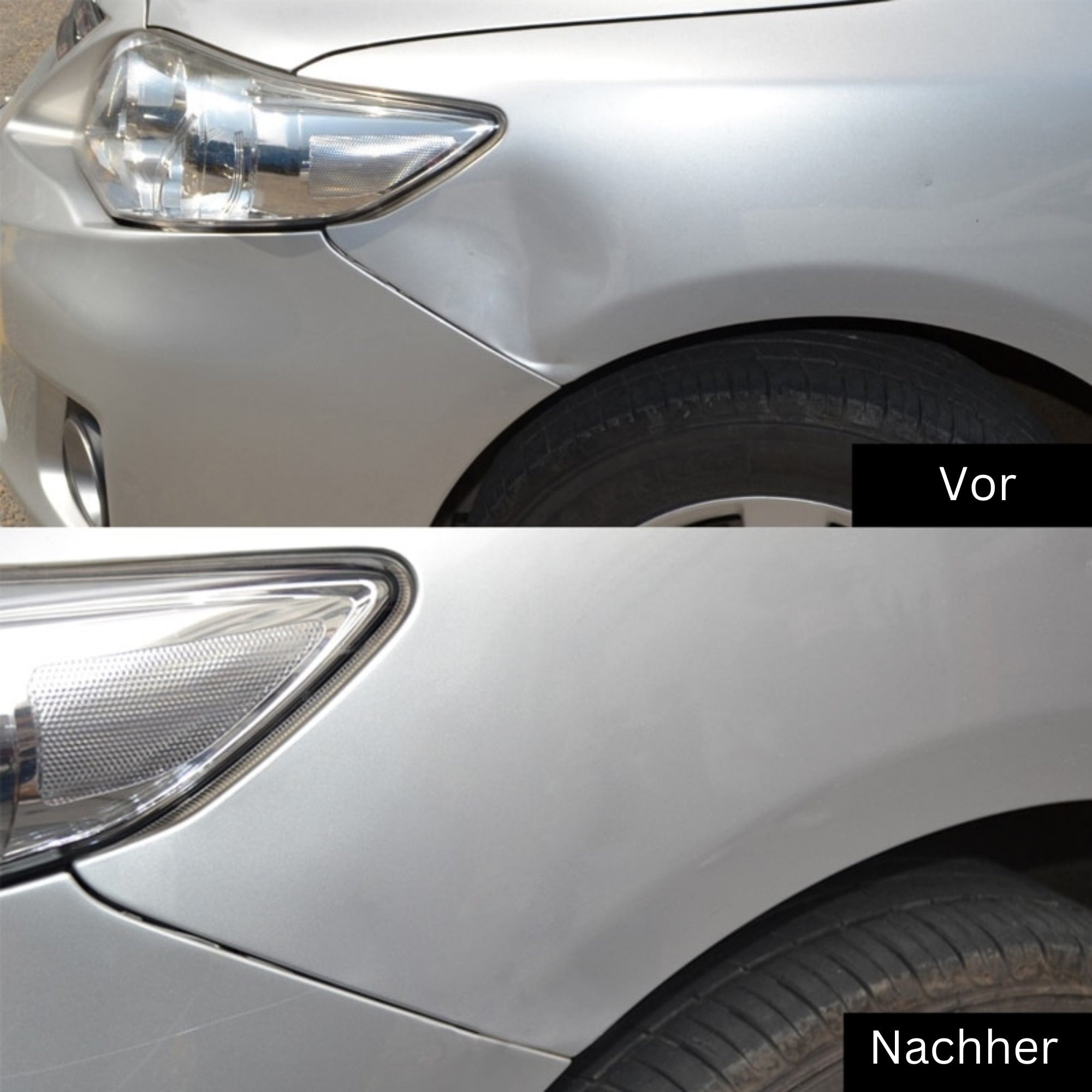 Dellen Im Auto